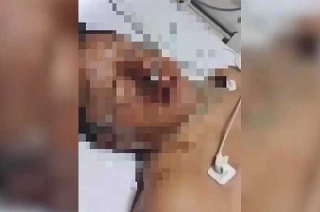 #Video: &quot;Era un niño&quot; el que disparó al alcalde de #ValleDeChalco, relata el particular