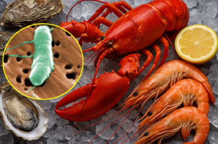 La Vibrio vulnificus es una bacteria letal que forma parte de la flora natural de las zonas costeras cálidas y puede ingresar al organismo mediante heridas abiertas o por consumo de mariscos contaminados.